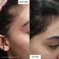Derma Roller